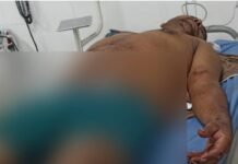Dice que quería abusar de ella y lo puñalió en Quebraditas