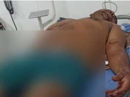 Dice que quería abusar de ella y lo puñalió en Quebraditas